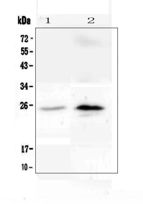 CRP / C-Reactive Protein Antibody