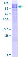 Human SIPA1L2 Protein (Recombinant GST)