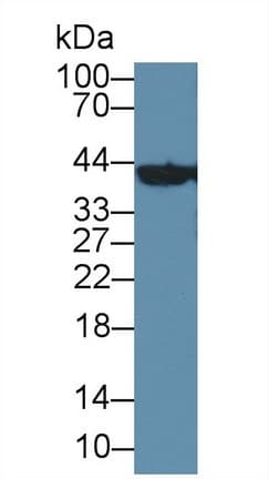 BCAT1 / ECA39 Antibody (PE)
