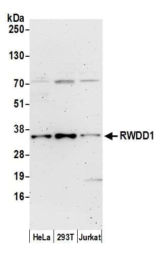 RWDD1 Antibody (aa193-243)