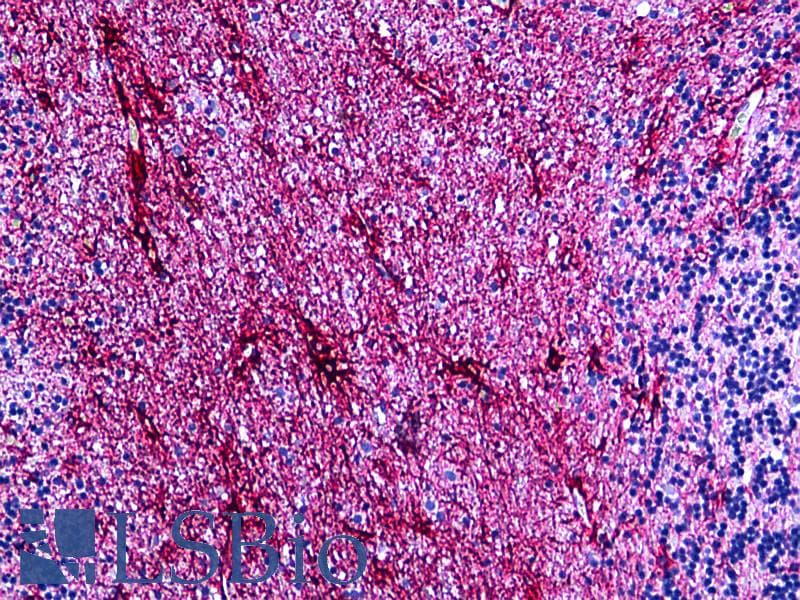 PathPlus™ GFAP Antibody (clone GFA-02)