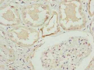 C1GALT1C1 Antibody