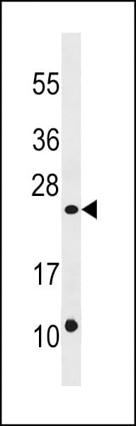 Polyclonal Rabbit anti-Human DUSP13 Antibody (aa147-173, WB)