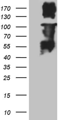 Monoclonal Mouse anti-Human MLH1 Antibody (clone OTI5H2, aa1-298, WB)
