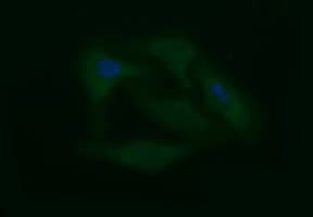 CD45 / LCA Antibody (clone OTI1B6)