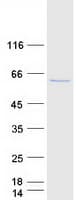 Human PAPSS2 Protein (Recombinant Myc-DDK (Flag))