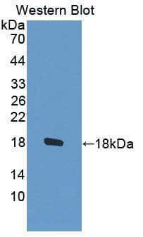 STAT5A Antibody (aa673-773)