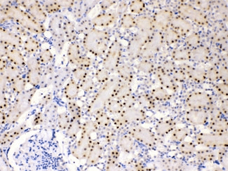 ADK / Adenosine Kinase Antibody