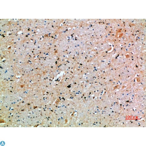 Polyclonal Rabbit anti-Human SPOP Antibody (WB)