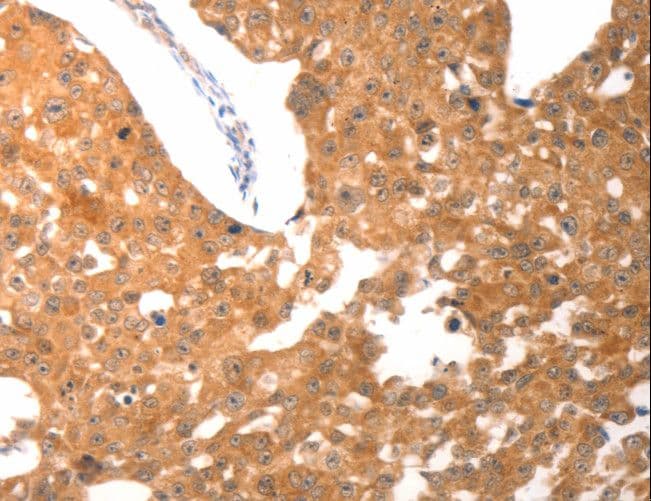 PARP1 Antibody