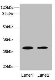 Polyclonal Rabbit anti-Human TPK1 Antibody (IHC, IF, WB)