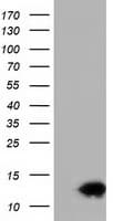 FSHB / FSH Beta Antibody (clone OTI4D12)