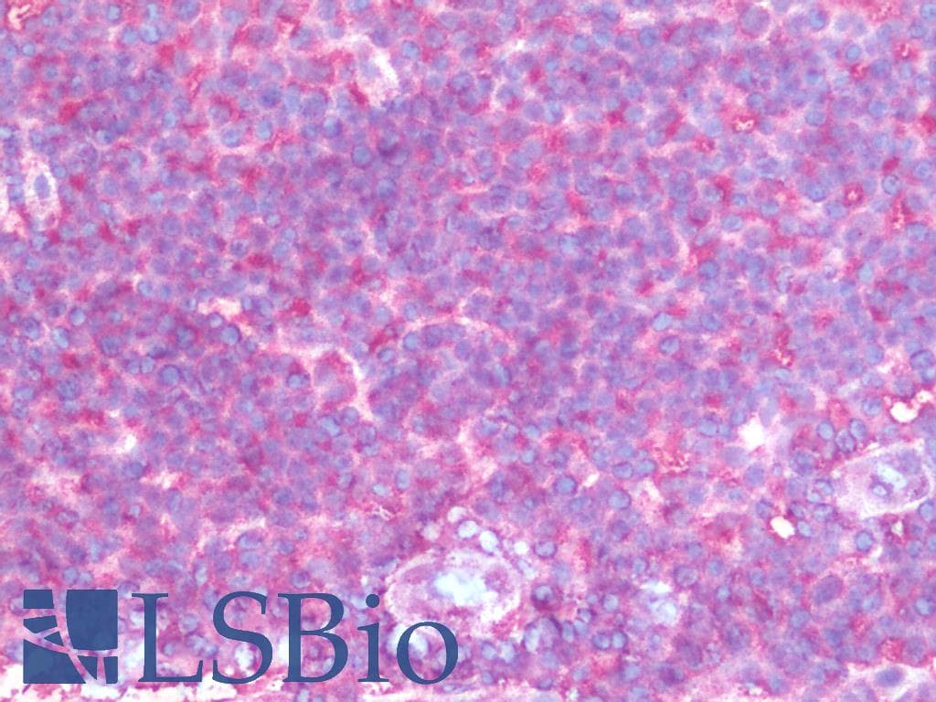 IHC-plus™ IFI16 Antibody (clone 4E6)