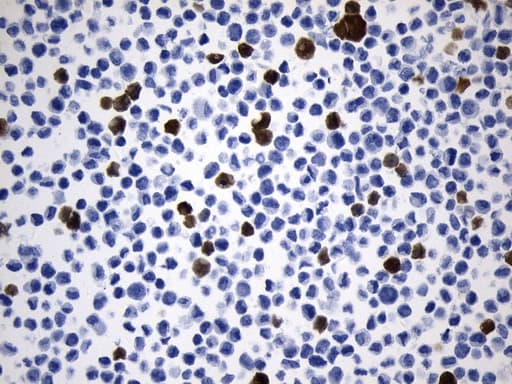 UCHL1 / PGP9.5 Antibody (clone UMAB244)