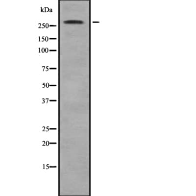 ACACB / ACC2 Antibody