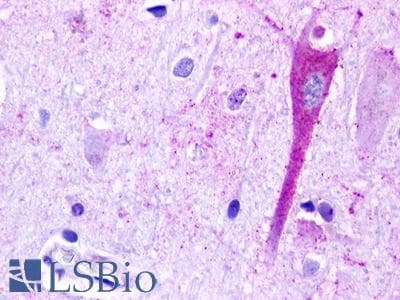PathPlus™ Polyclonal Rabbit anti-Human GPR183 / EBI2 Antibody (Extracellular Domain, IHC)