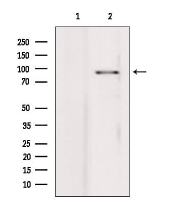 PIBF1 / PIBF Antibody