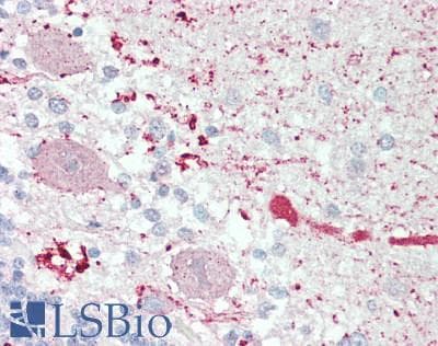 Polyclonal Rabbit anti-Human DIXDC1 Antibody (aa550-600, IHC)