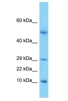 Polyclonal Rabbit anti-Human Neuropeptide Y / NPY Antibody (aa21-70, WB)