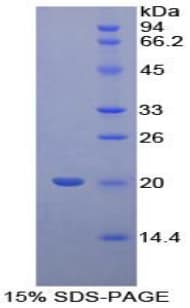 Human PPIB / Cyclophilin B Protein (Recombinant His)