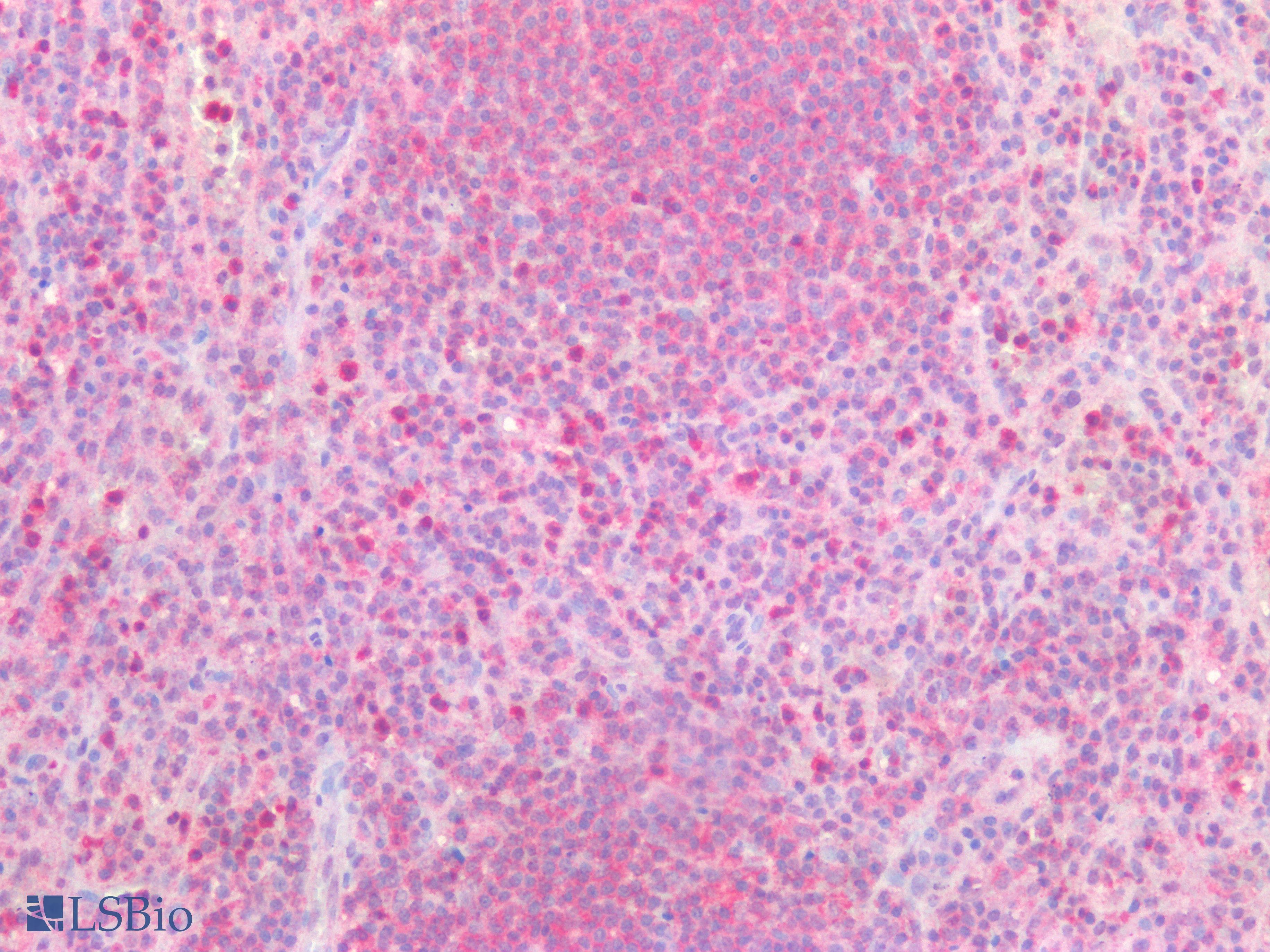 PathPlus™ PD-L2 / PDCD1LG2 / CD273 Antibody