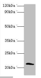 SSX2 Antibody (aa1-188)