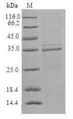 Cucumber ORF1a Protein (Recombinant 6His, C-terminus)