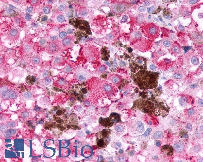 PathPlus™ Polyclonal Rabbit anti-Human CRHR2 / CRF2 Receptor Antibody (Extracellular Domain, IHC)