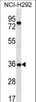 TSGA13 Antibody (aa164-192)
