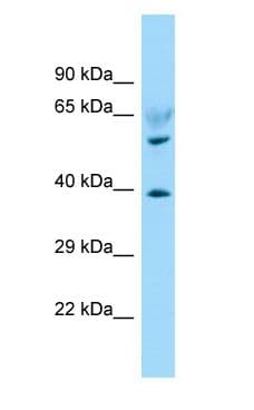 LPAR6 / P2RY5 / P2Y5 Antibody (aa266-315)