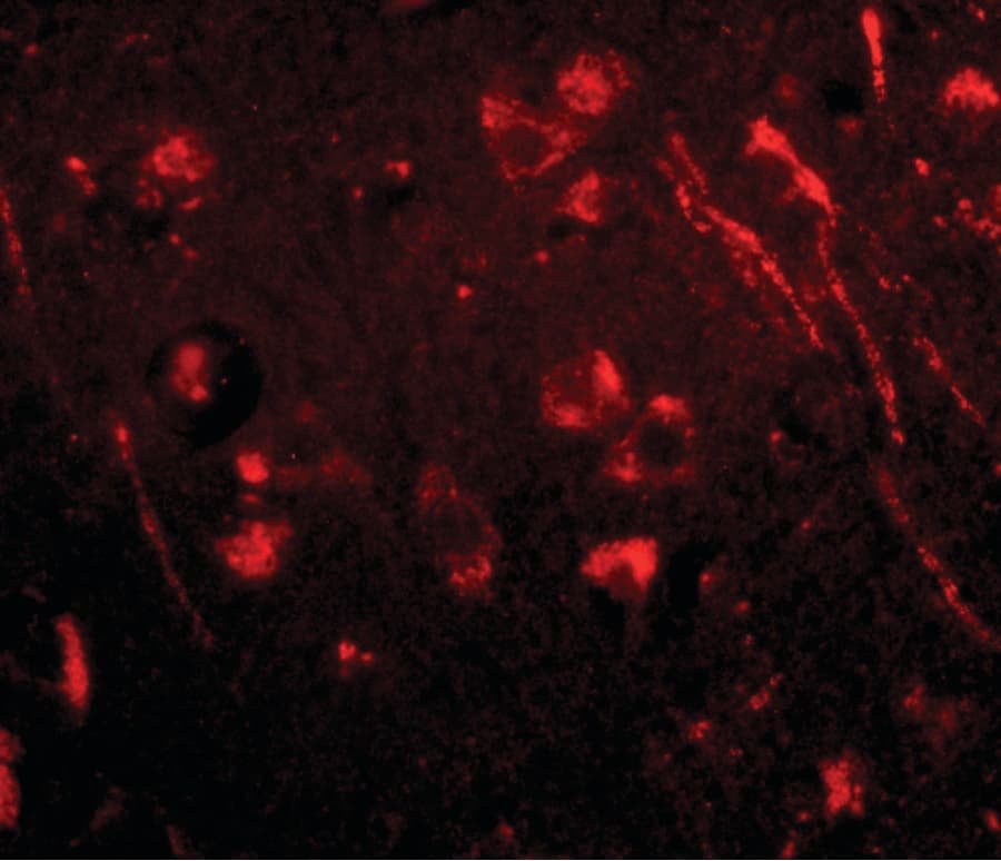 IHC-plus™ Polyclonal Rabbit anti-Human AIPL1 Antibody (IHC, IF, WB)