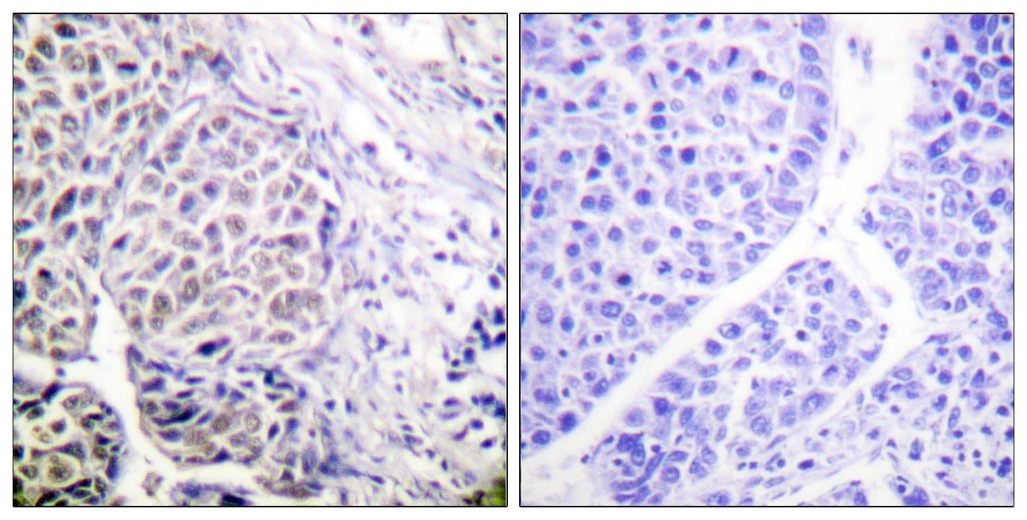 AURKB / Aurora-B Antibody (phospho-Tyr12)