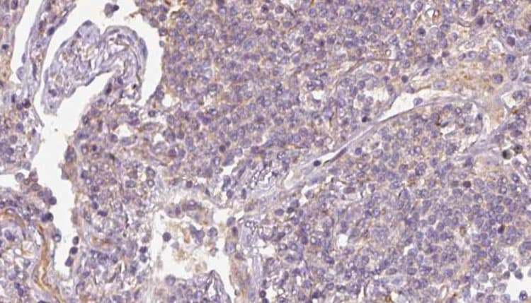 Polyclonal Rabbit anti-Human SRP14 Antibody (IHC, IF, WB)