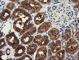 Monoclonal Mouse anti-Human HDAC6 Antibody (clone OTI1B3, IHC, IF, WB)