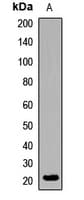 Polyclonal Rabbit anti-Human TBPL1 / TRF2 Antibody (IF, WB)