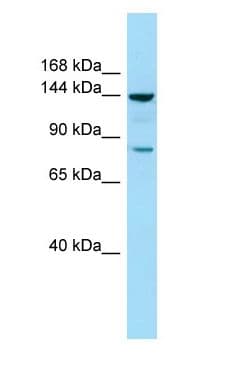 Polyclonal Rabbit anti-Human CYFIP1 Antibody (aa1159-1208, WB)