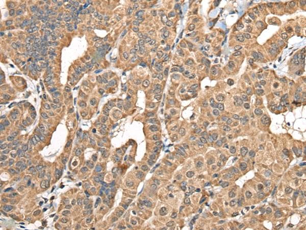 Polyclonal Rabbit anti-Human NADK2 / C5orf33 Antibody (IHC, WB)