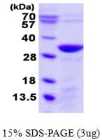 Human UNC119B Protein (Recombinant His)