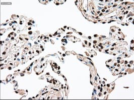 SSB / La Antibody (clone OTI2C8)