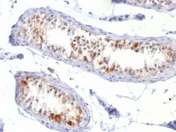 MLANA / Melan-A Antibody (clone MLANA/788)