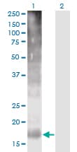 TM4SF4 Antibody (clone 4E6)