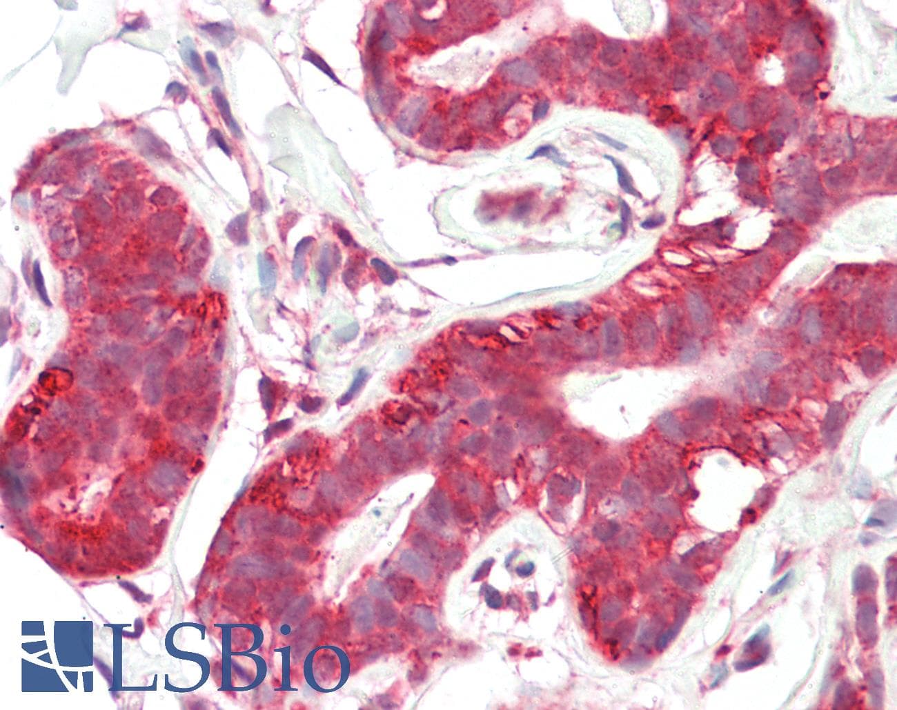 IHC-plus™ Monoclonal Mouse anti-Human YWHAH / 14-3-3 Eta Antibody (IHC, IF, WB)