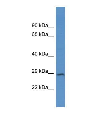 Polyclonal Rabbit anti-Human JPH4 Antibody (aa510-559, WB)