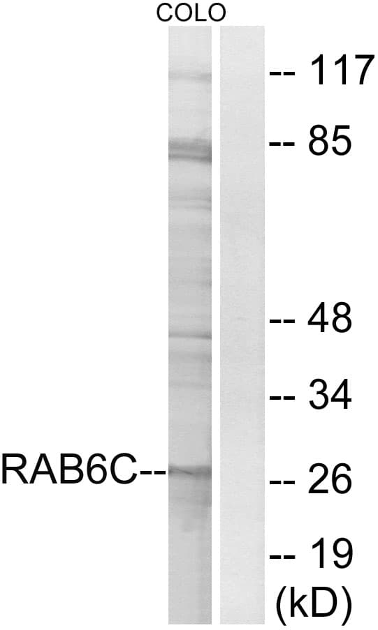 IHC-plus™ Polyclonal Rabbit anti-Human RAB6C Antibody (aa165-214, IHC, WB)