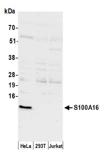 S100A16 Antibody (aa53-103)
