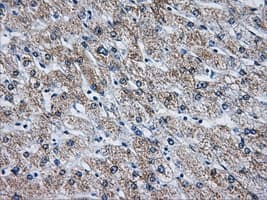 ATP5B / ATP Synthase Beta Antibody (clone OTI3H8)