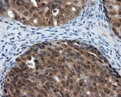 LIPG / Endothelial Lipase Antibody (clone OTI6E11)