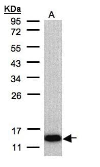 Polyclonal Rabbit anti-Human COX6A2 Antibody (aa34-97, IHC, WB)
