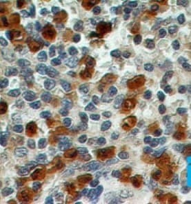 S100A8 / MRP8 Antibody (aa2-82, clone 48M7C7, Azide-free)