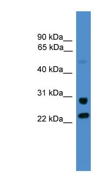 KIAA0152 / MLEC Antibody (aa214-263)